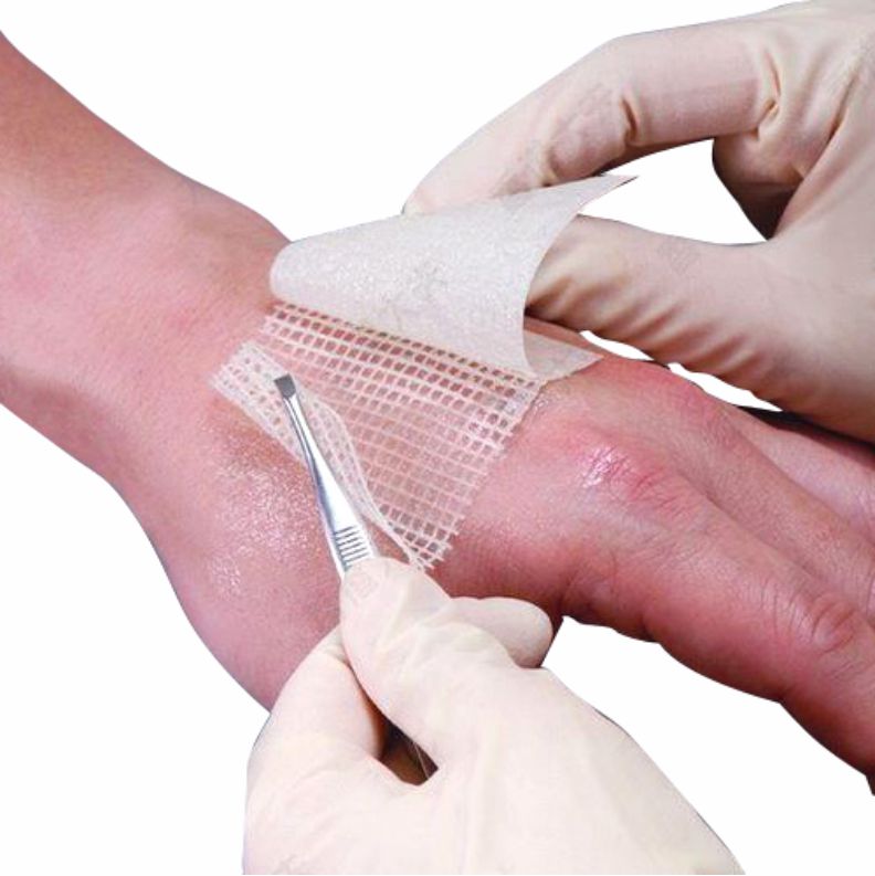 Curativo Antisséptico Bactigras 10cm x 10cm (01UN) - Smith&Nephew - Imagem 2